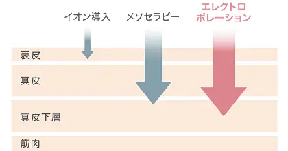 エレクトロポレーションの導入効果比較